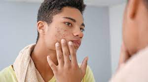 Skin Cancer